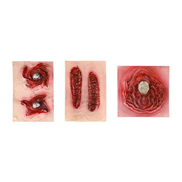 the self-adhesive scars, 3 types 2
