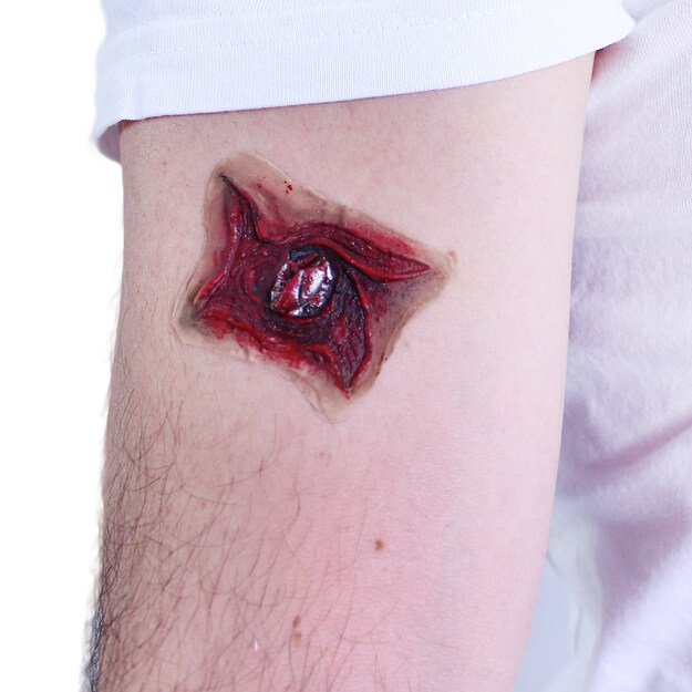 the self-adhesive scars, 3 types 5