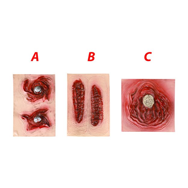 the self-adhesive scars, 3 types 4