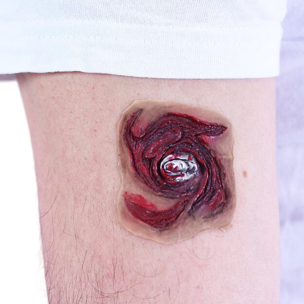 the self-adhesive scars, 3 types 6